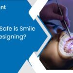 How Safe is Smile Designing?