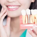 Best Dentist in Jaipur
